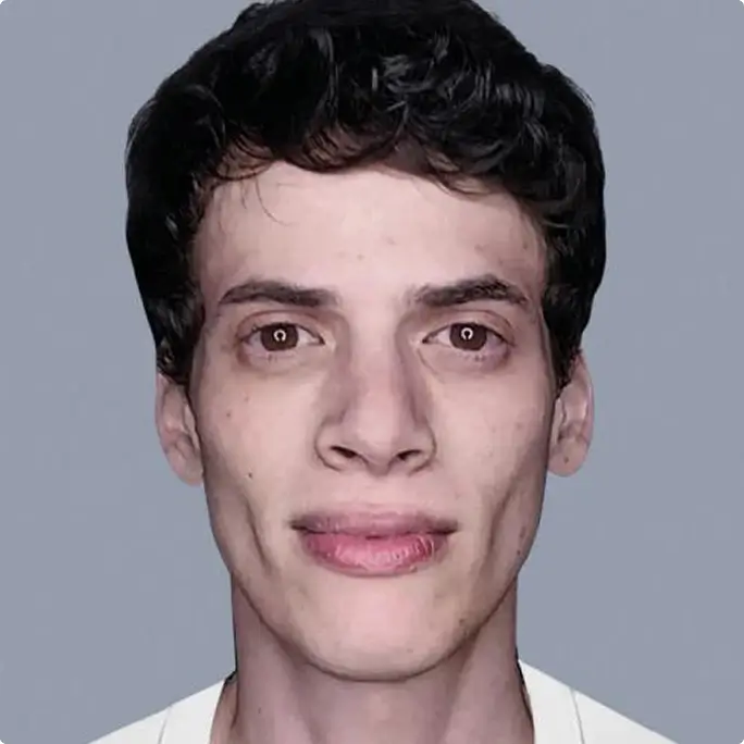 Before/After Image